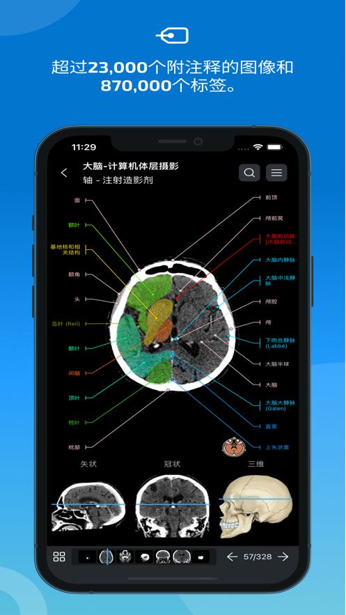 e-anatomy软件截图2