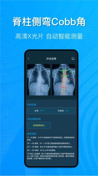 体态评估大师图片