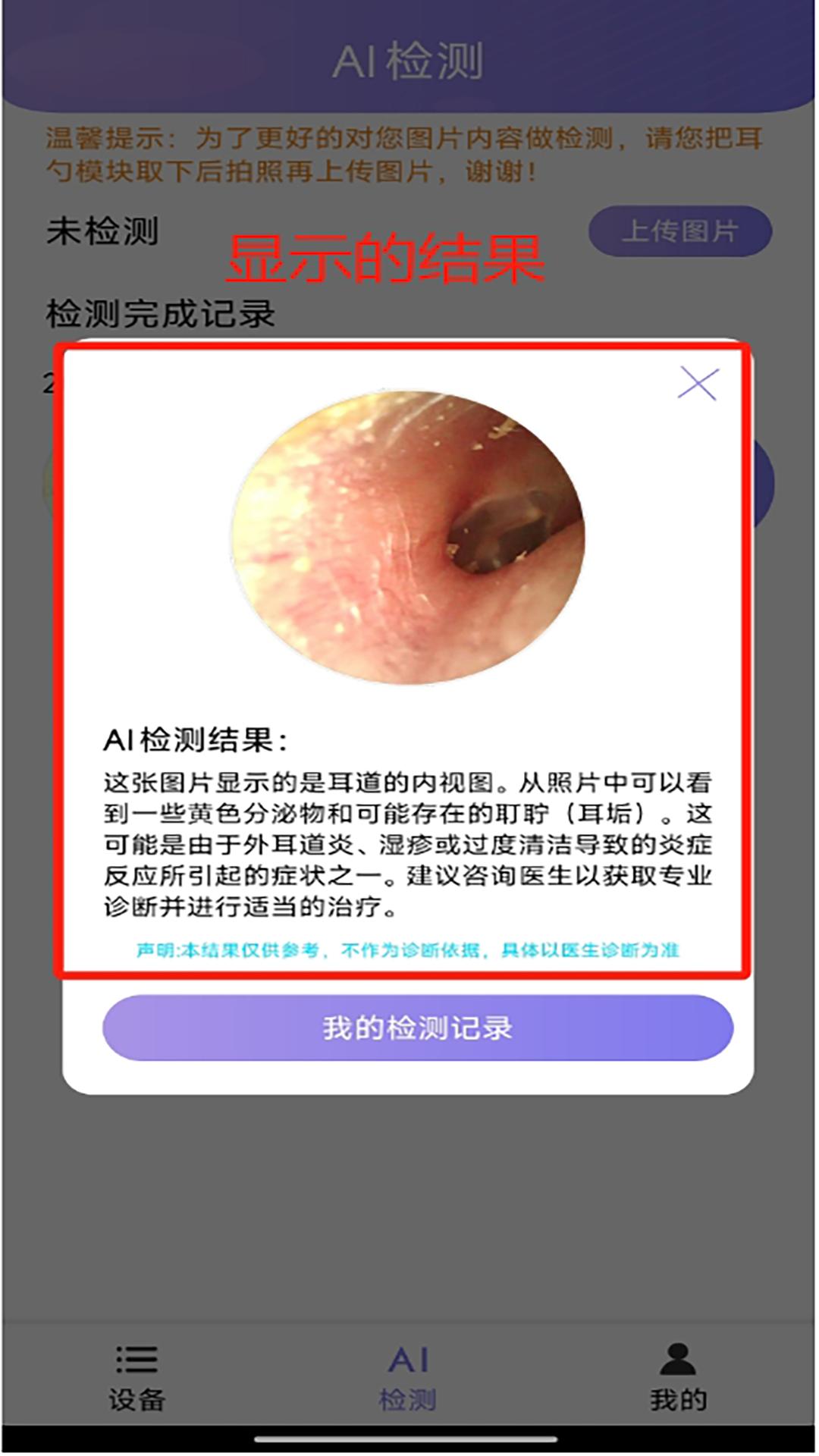 Ai耳勺 v5.2.4
