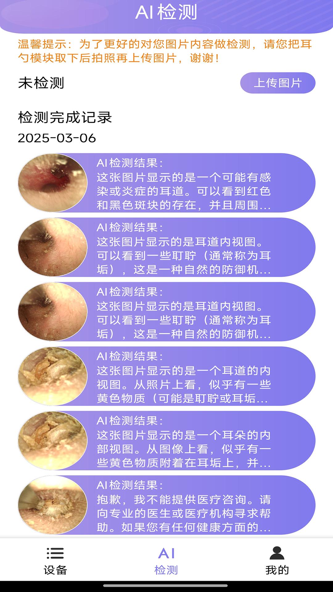 Ai耳勺 v5.2.4