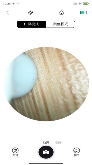 挖耳勺软件安卓手机版v1.0.076 安卓版 v6.1.2