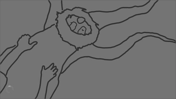 阿尔茨海默守护12