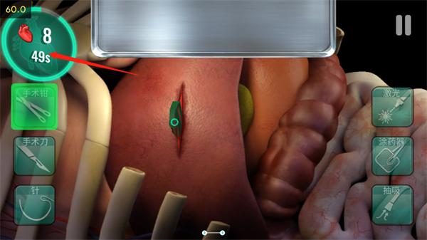 医院手术时间15