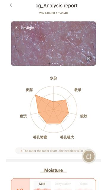 MoreMe水肤镜app(MoreMeSPA)