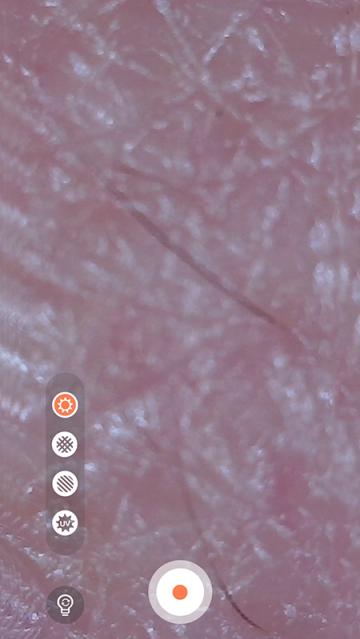 MoreMe水肤镜app(MoreMeSPA)