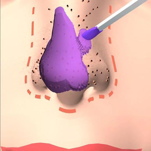 挤黑头大师手游 0.2安卓版