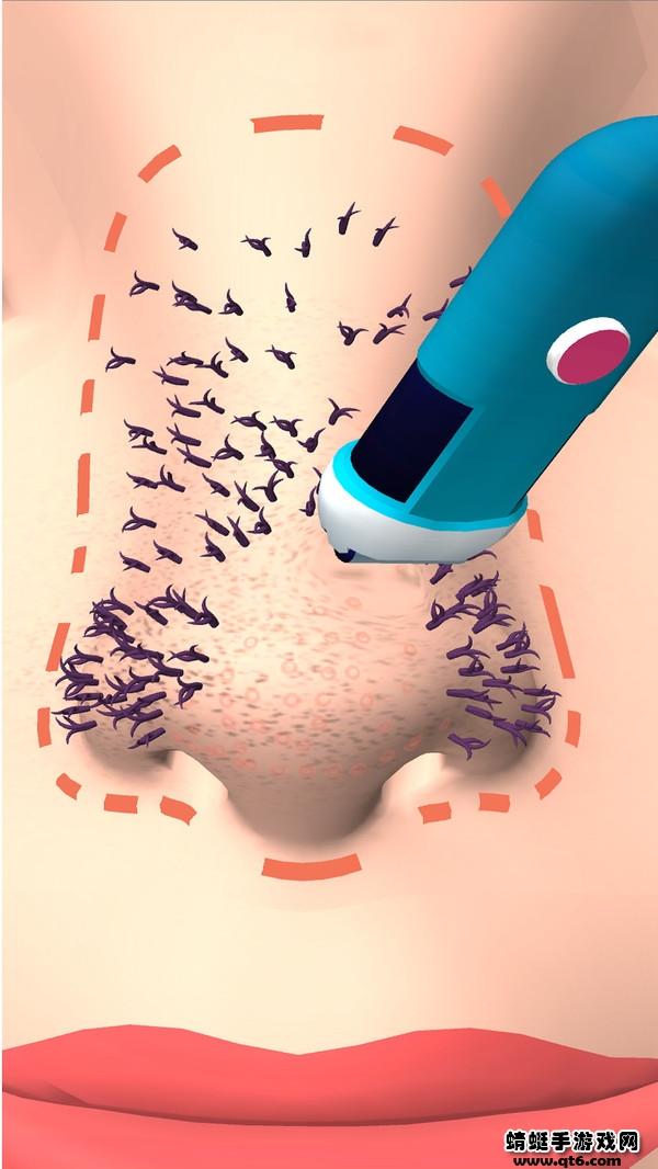 挤黑头大师手游 0.2安卓版