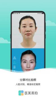 医美易拍 v3.0.5