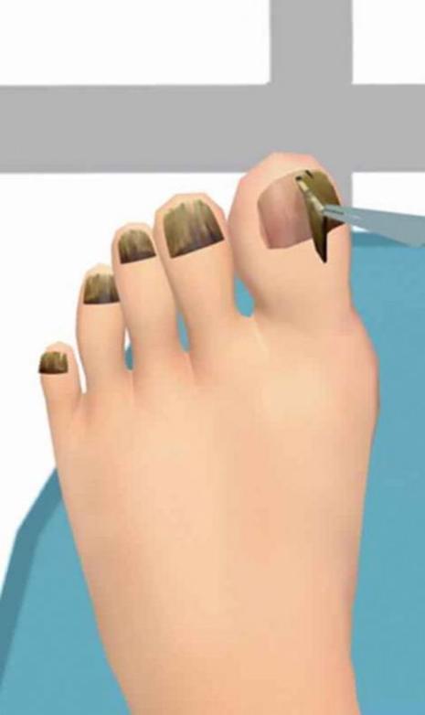 老板来修脚 v4.0