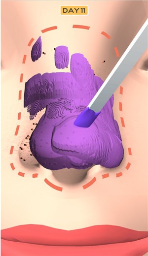 鼻子美容师  v1.0.2