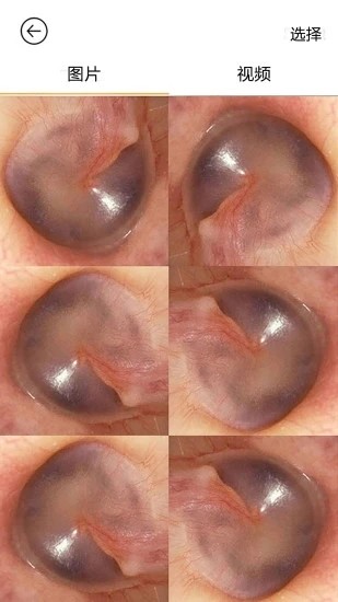 蜂鸟采耳app v6.1.52