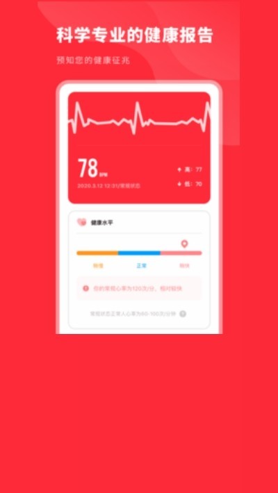 口袋心电图 2020-09-03 17:27