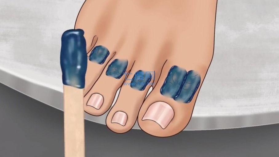 修脚足疔模拟器游戏