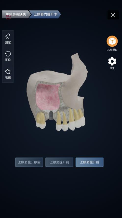聊牙 版本:v1.8.0