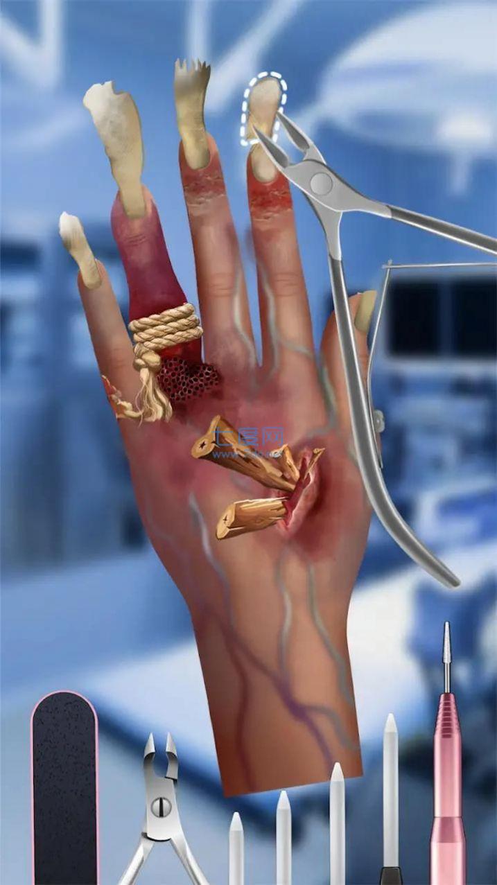 粉刺达人游戏 v0.0.3