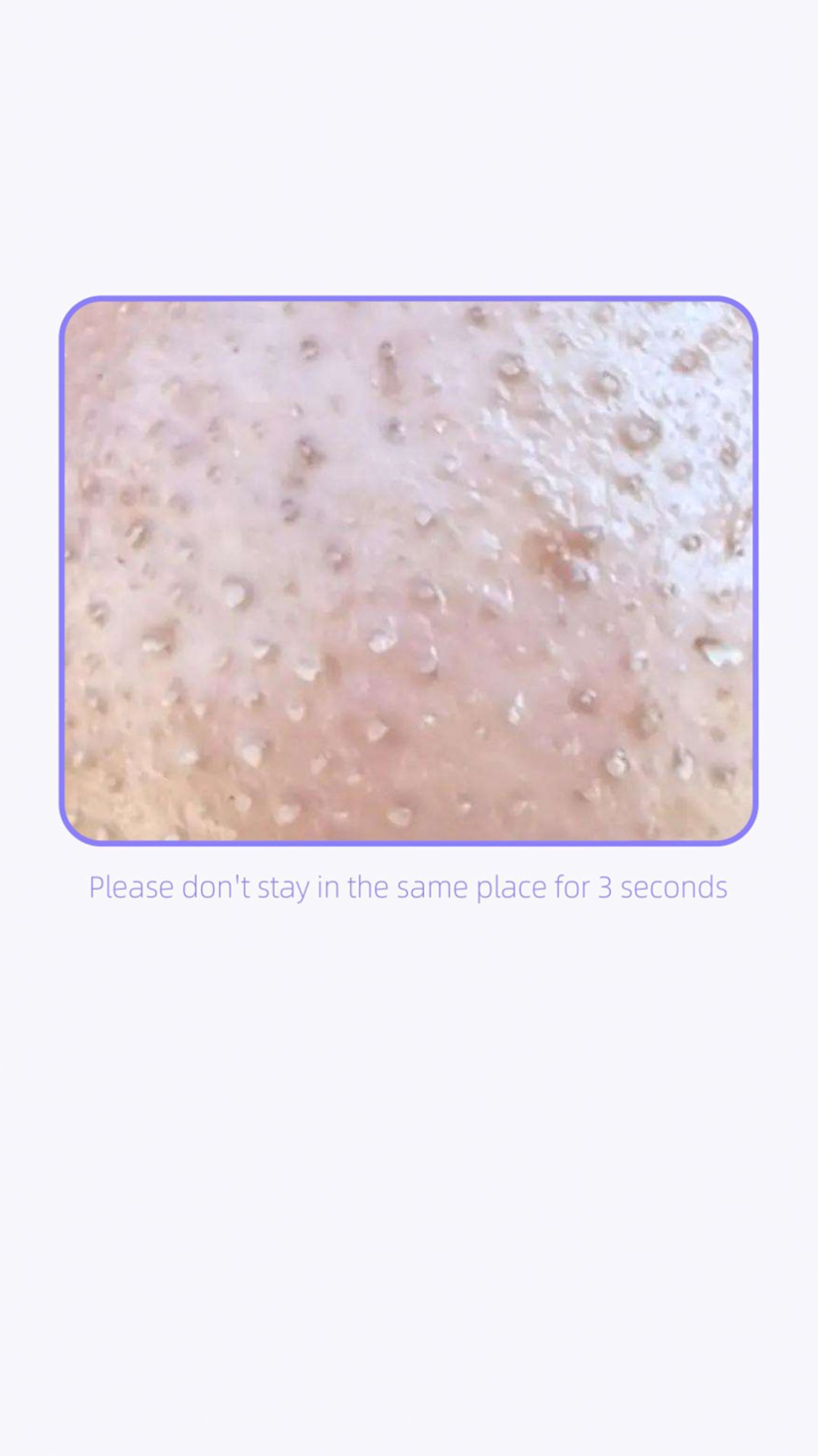 精致生活皮肤测试仪APP官方下载  v4.4.1