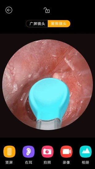 蜂鸟采耳app v6.1.52