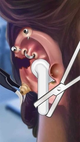 粉刺达人手机版  v0.0.3