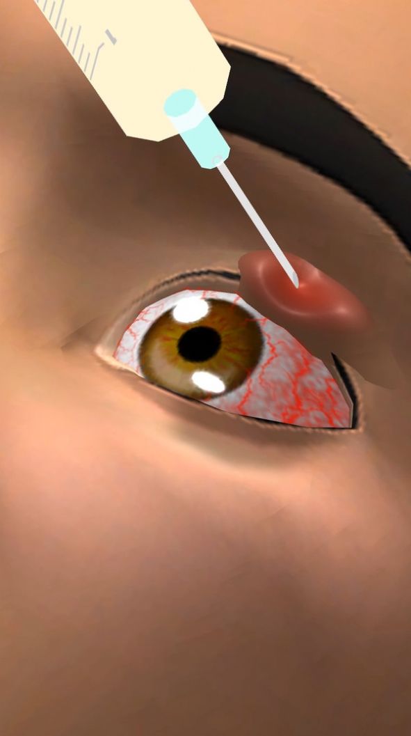 眼科医生游戏中文官方版  v3.1.2