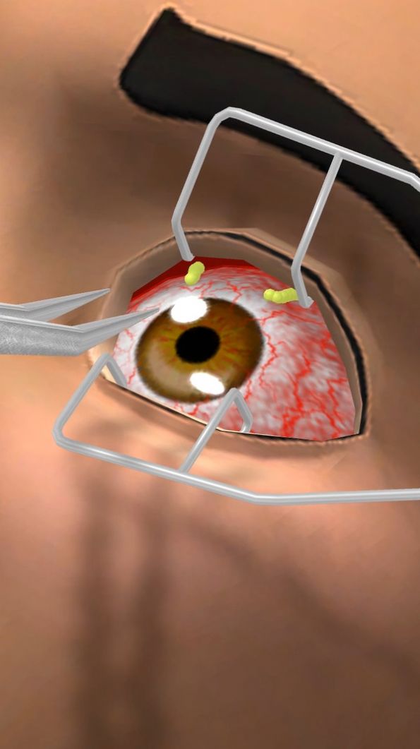 眼科医生游戏中文官方版  v3.1.2