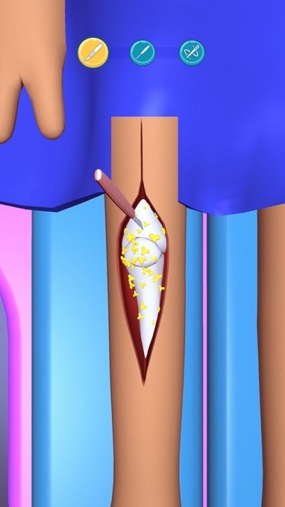 外科手术大师3D  v1.14