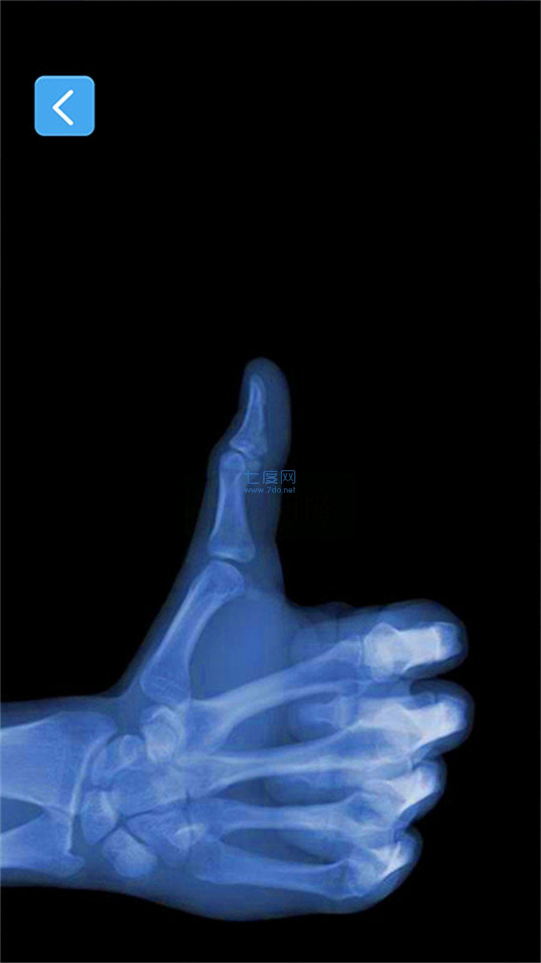 X射线模拟器 v1.0