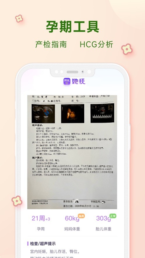 她抚孕育  V 2.0.0
