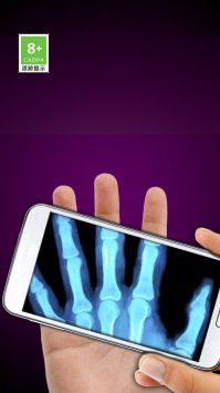 模拟X射线 v3.0.5