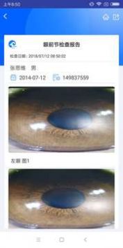 KJ裂隙灯截图2