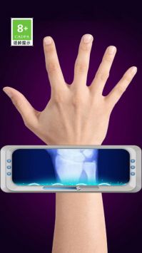 模拟X射线 v3.0.5