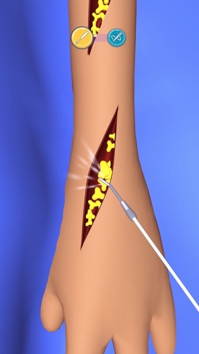 外科手术大师3D  v1.14