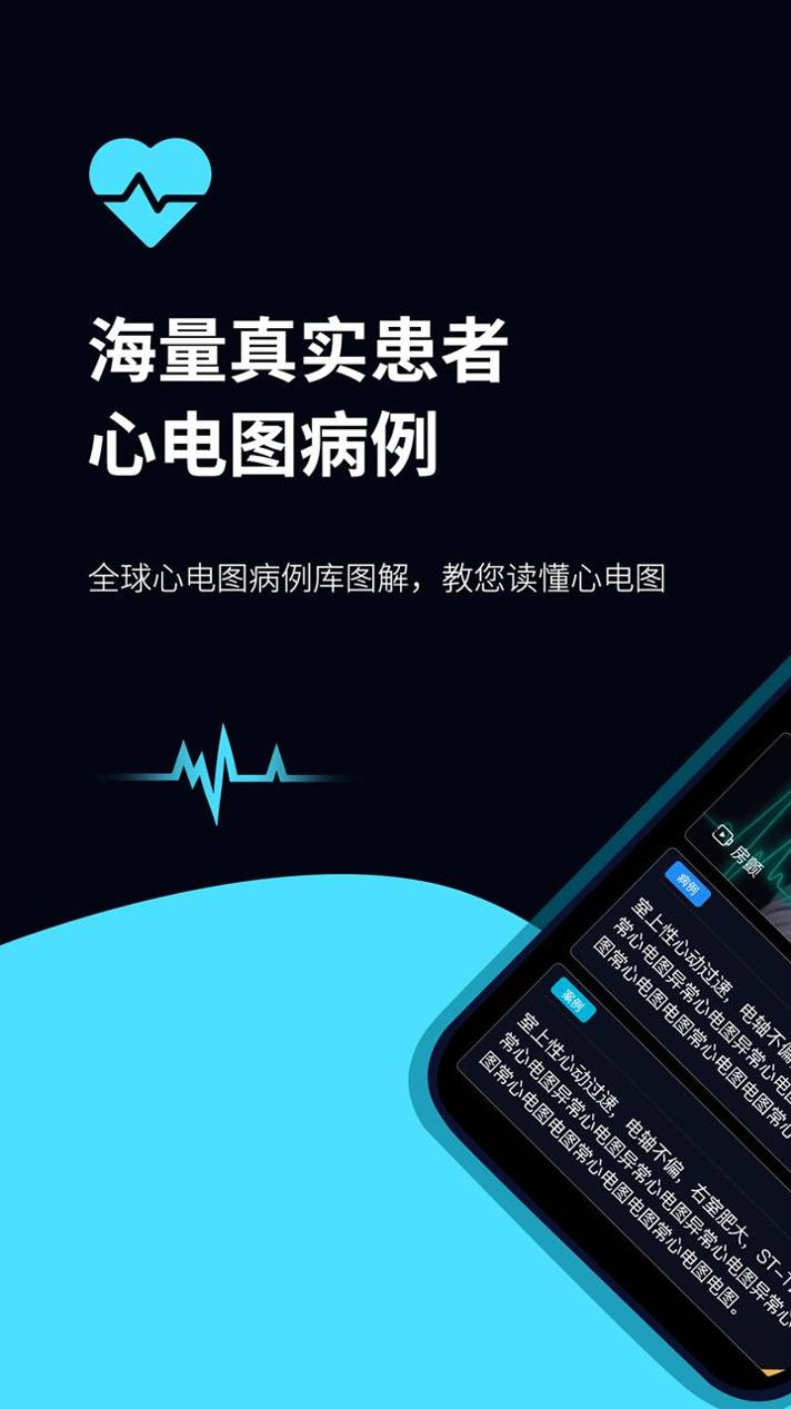心电图ECG v3.2.5