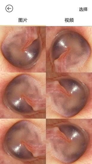 bebird挖耳勺app(蜂鸟采耳) v6.1.52 安卓版