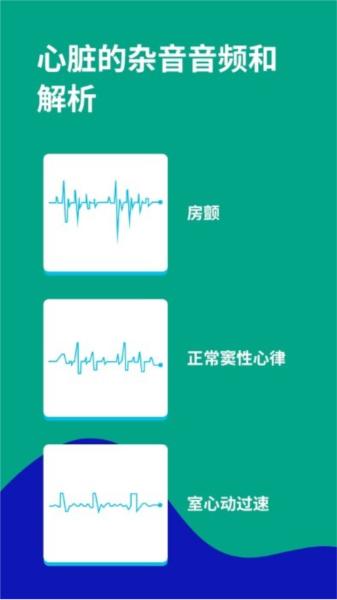 心电图ECG 安卓版v1.7