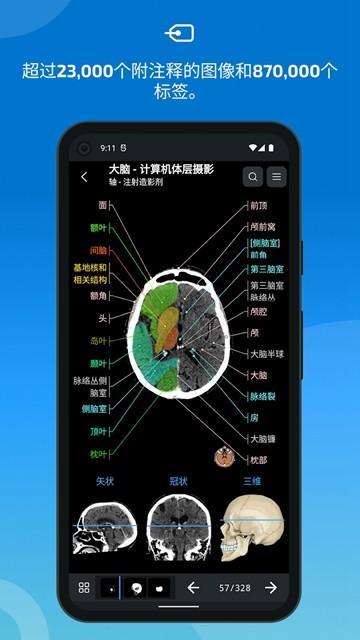 IMAIOS e-Anatomy 安卓最新版v7.4.9 安卓最新版v7.4.9