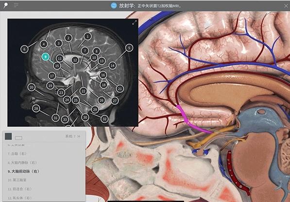 Complete Anatomy图片2
