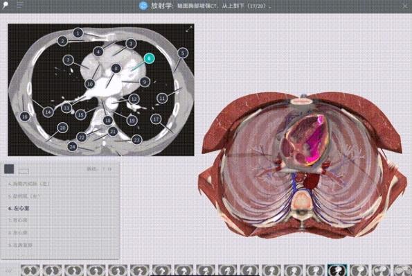 Complete Anatomy图片11