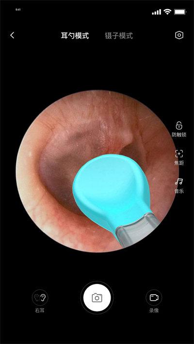 bebird智能可视采耳 