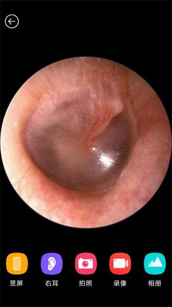 蜂鸟采耳app旧版本