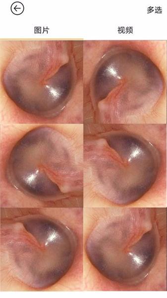 蜂鸟采耳app旧版本  v6.4.3