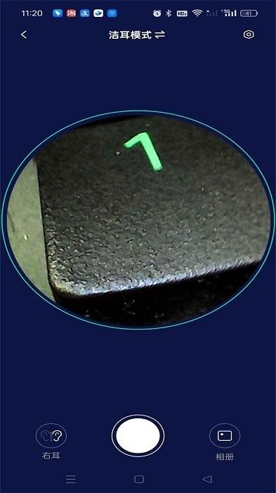 iSEE可视耳勺 v3.0.1