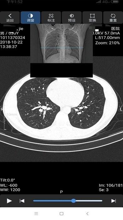 飞图影像app v3.4.2