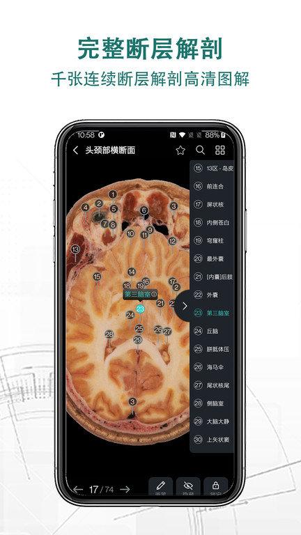 掌上3d解剖app v3.4.2