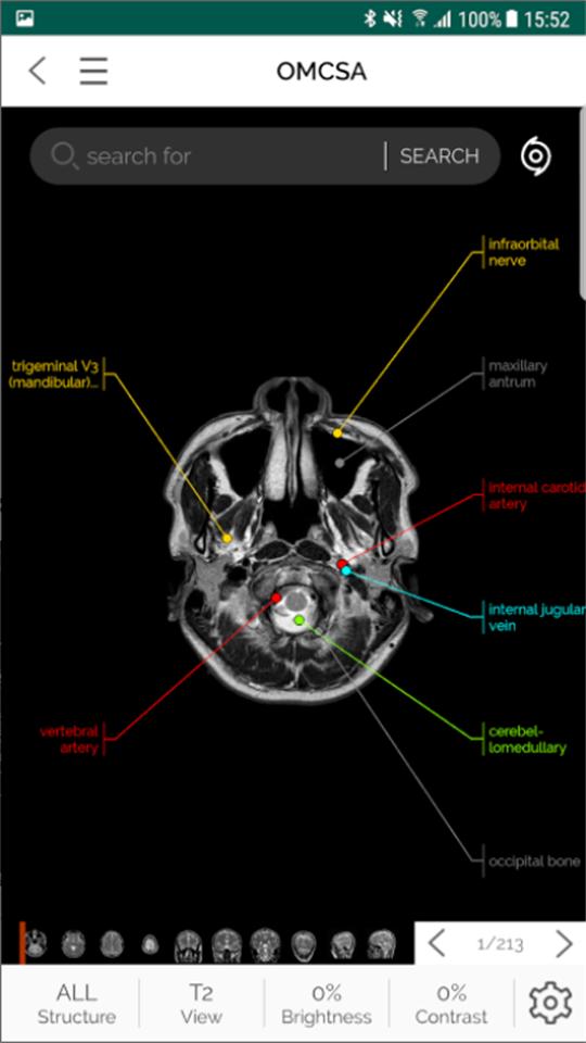 OMCSA软件v1.4.6 手机版 v6.1.1