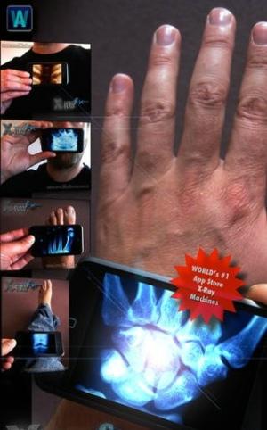 手机扫描骨骼x光